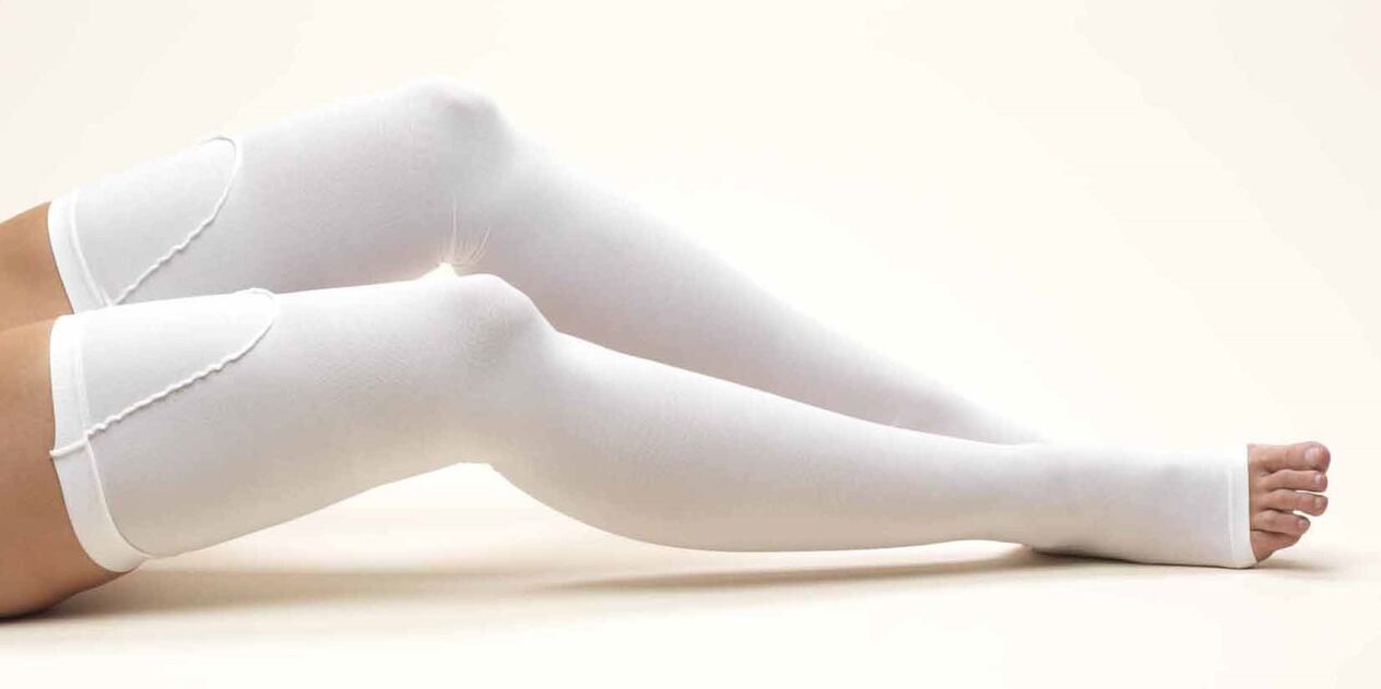 compression stockings para sa varicose veins