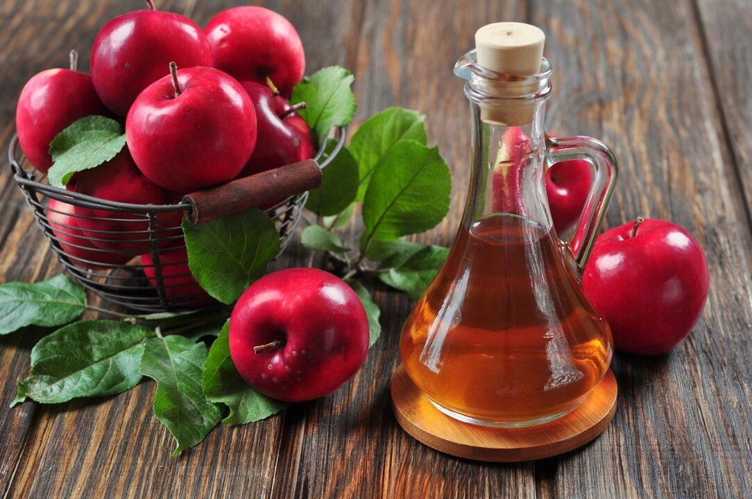 Apple cider vinegar para sa mabisang paggamot ng varicose veins
