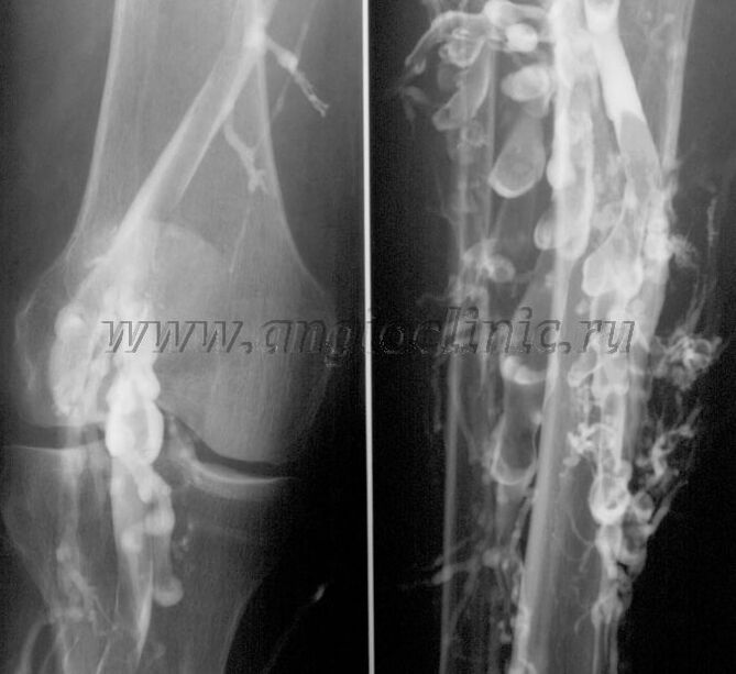 Pag-scan sa ultratunog